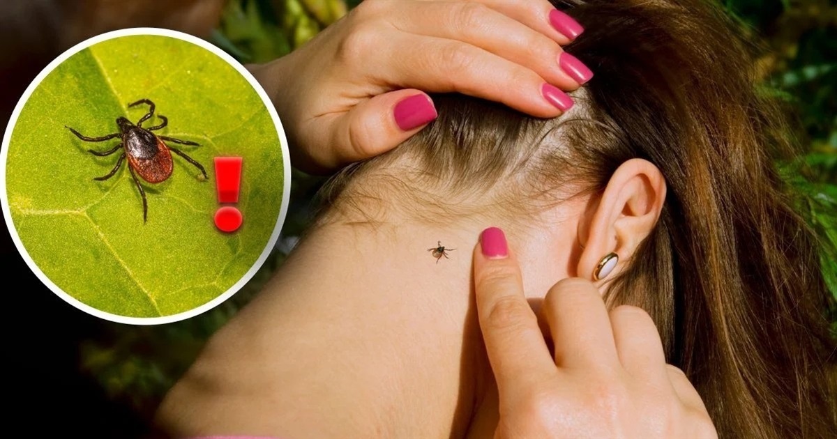 Кліщі виходять на полювання: як захистити себе та домашніх улюбленців