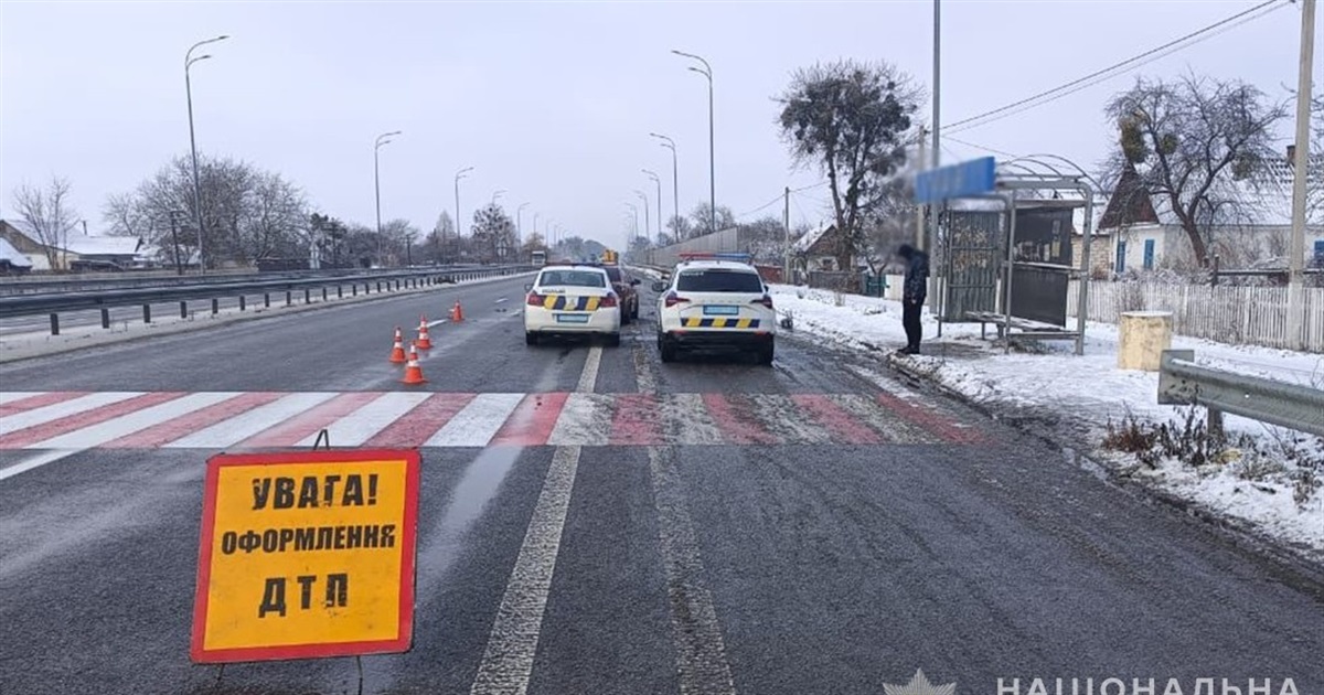 Зіткнулися автівка та візок з електричним приводом — жителя Звягельщини доставили до лікарні