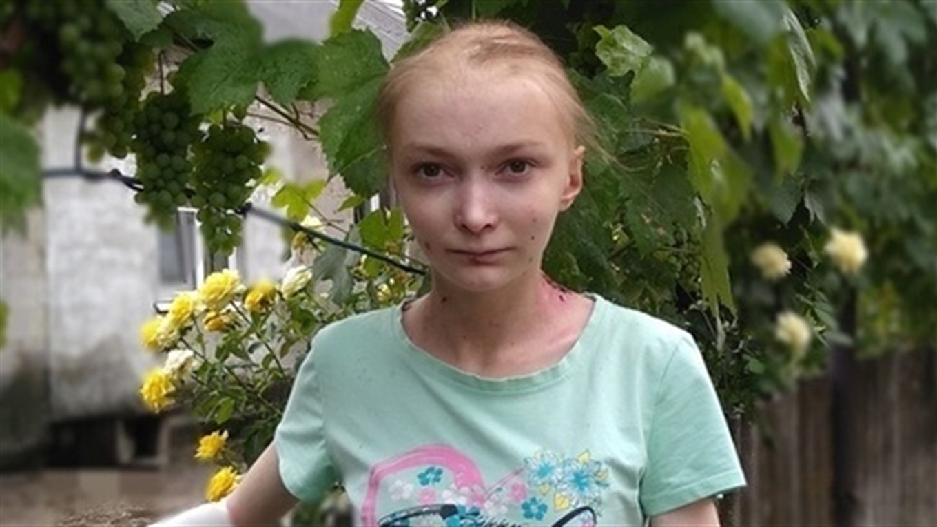 Помоги своим. 16-летняя Аня борется с неизлечимым "синдромом бабочки". Объясняем, как ей помочь