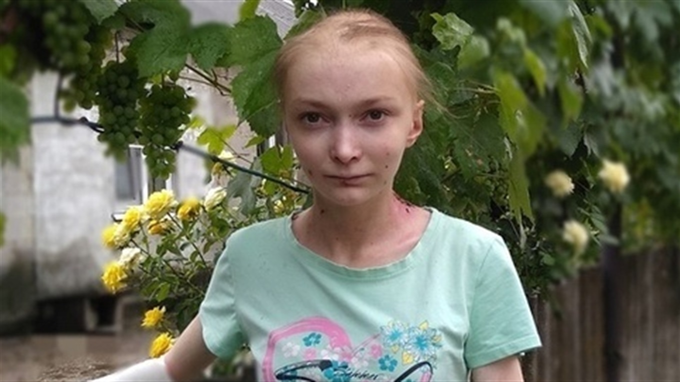 Помоги своим: 16-летняя Аня борется с неизлечимой болезнью и нуждается в помощи