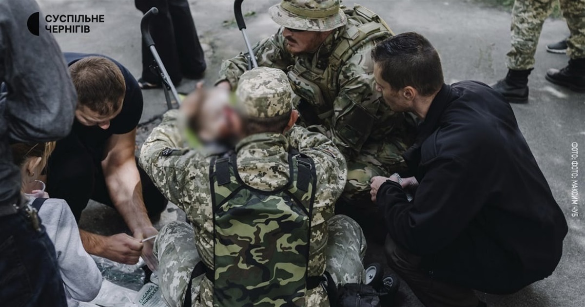 На виставці боєприпасів у Чернігові вибухнув гранатомет: дворічний хлопчик у реанімації. ВІДЕО
