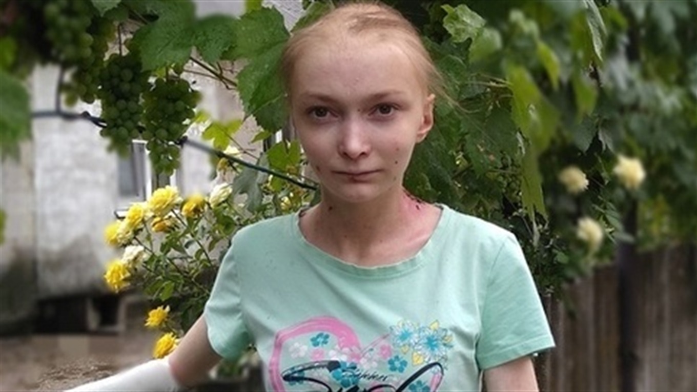 Помоги своим: 16-летняя Аня борется с неизлечимой болезнью и нуждается в помощи