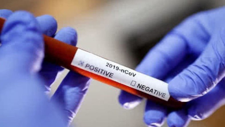Рекомендації ВОЗ для осіб з підозрою на COVID-19, які перебувають у самоізоляції