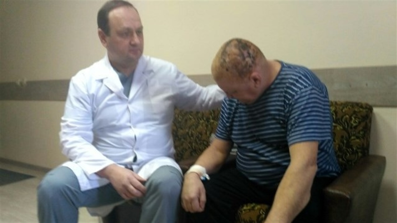Обстежуючи шахтаря з Горлівці, лікарі ахнули: ракова пухлина ледь не досягла розмірів голови
