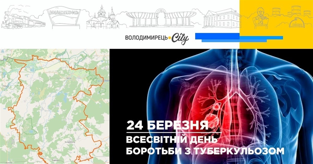 У Вараському районі є хворі на туберкульоз. Яка статистика і у яких громадах?