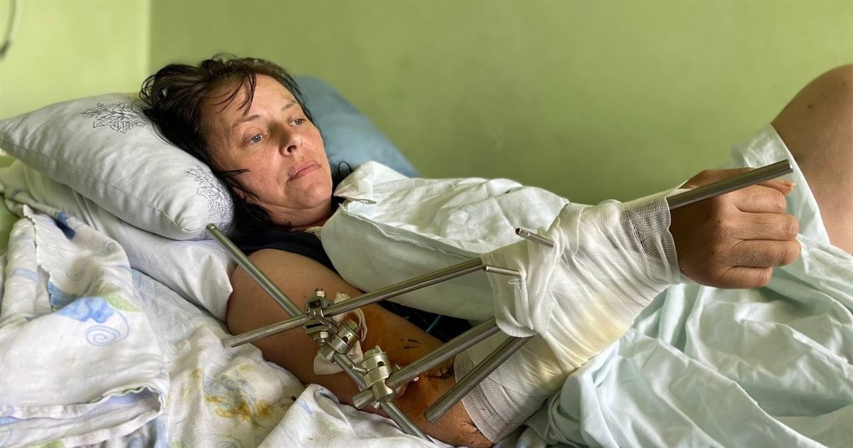 Мене засипало землею у воронці від ракети в Бахмуті. Я дивом вижила, тепер лікарі рятують мою ногу