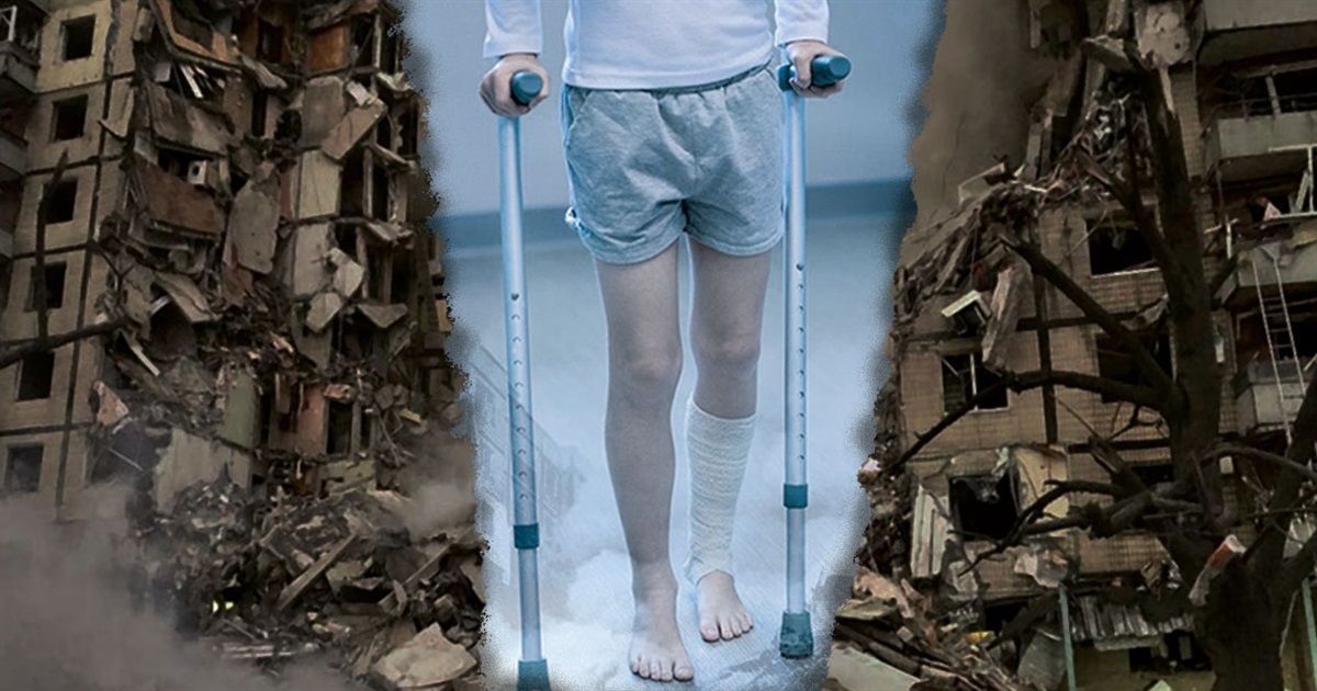 Коли цивільні можуть отримати статус особи з інвалідністю внаслідок війни: пояснюють юристи