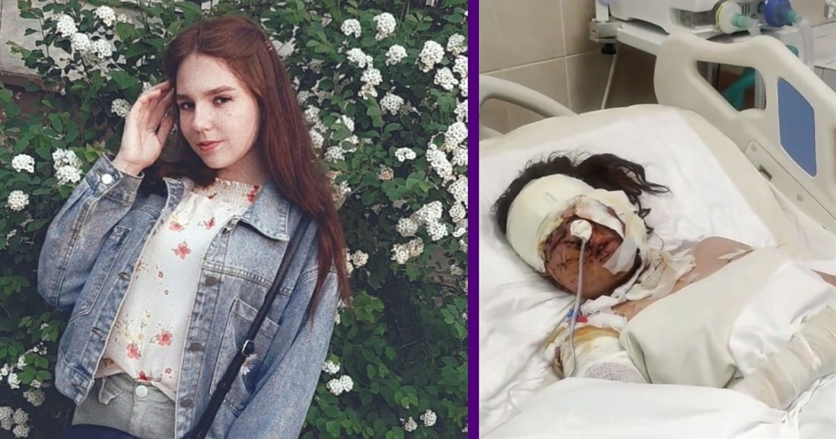 Анна Котова з Сєвєродонецька в реанімації. Росія вдарила в будинок ракетою в день її народження