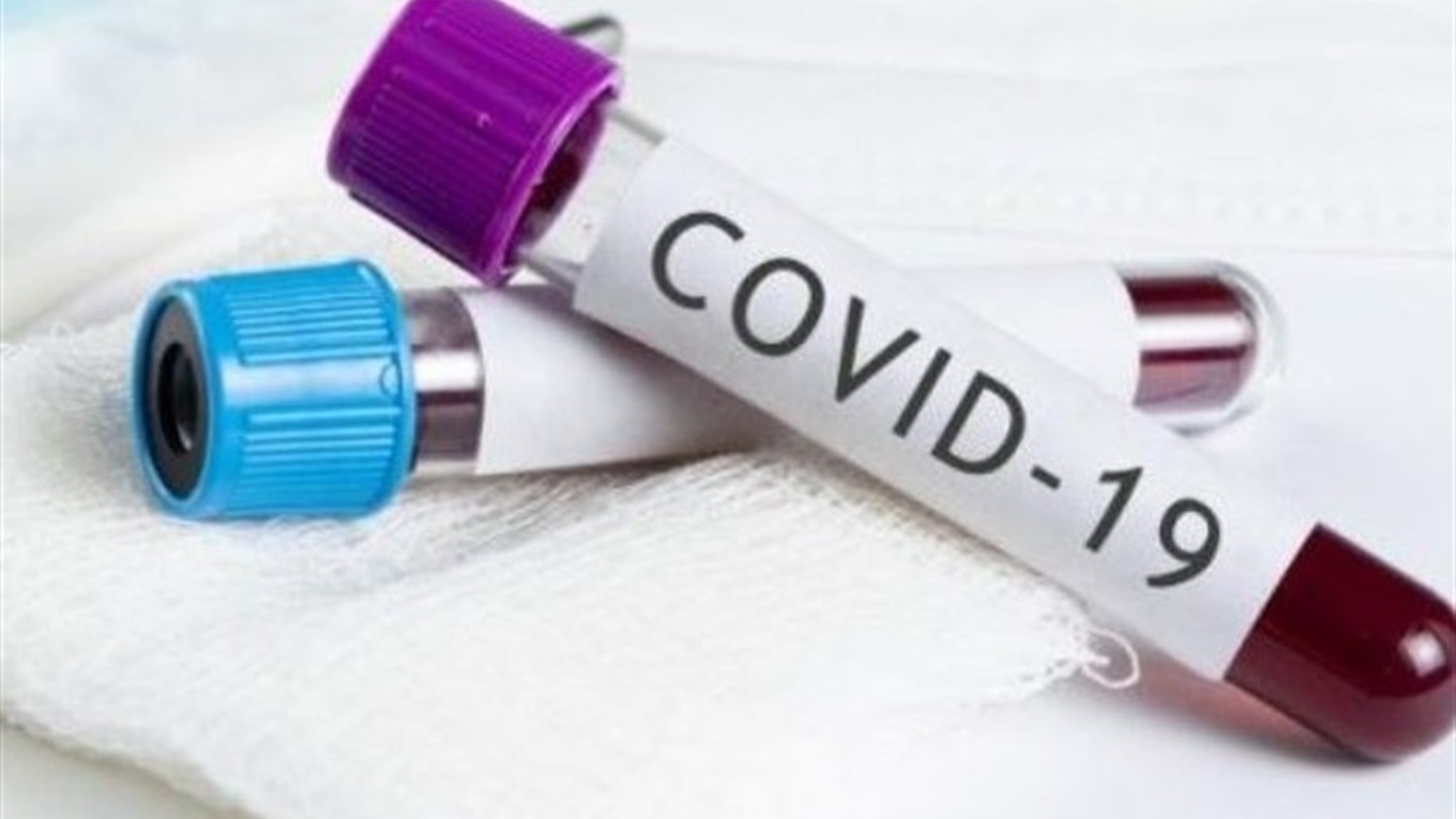 У Старокостянтинові підтверджено 3 випадок захворювання на COVID-19 