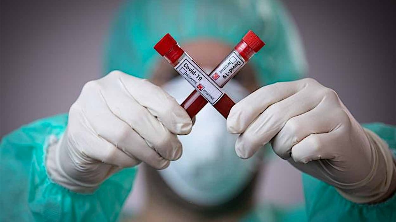 Эпидситуация в Измаиле на 17 июня: число заболевших продолжает расти