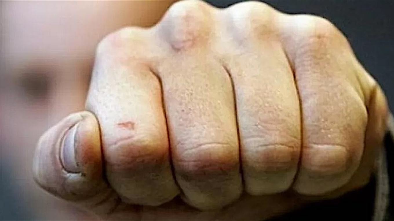 В Измаиле трое парней избили полицейского до потери сознания