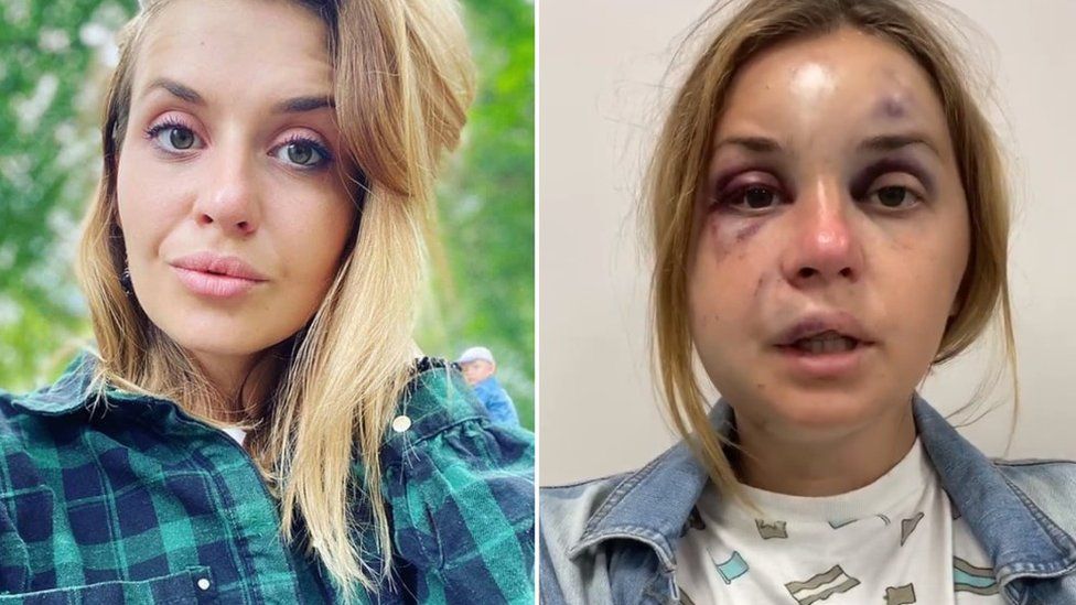 Не сама винна: чому суспільство звинувачує постраждалих від насильства, і що з цим робити 
