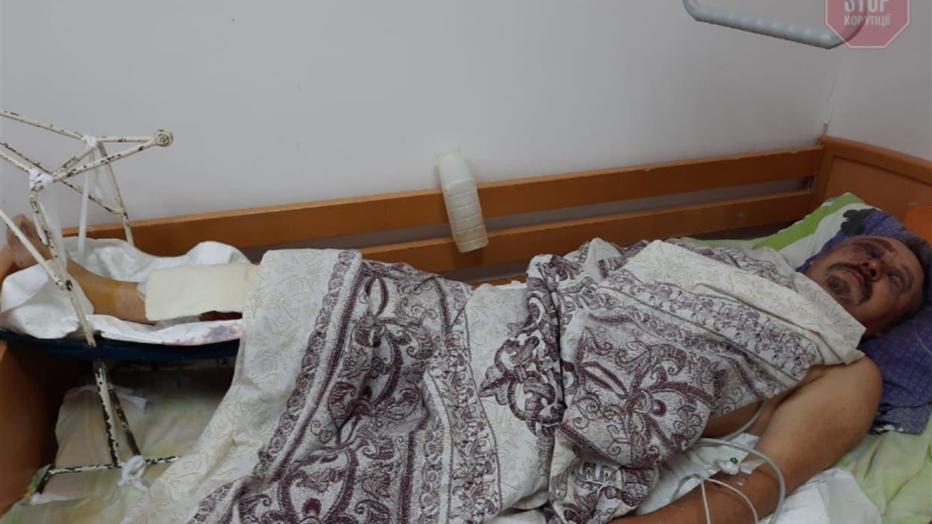 У Волновасі невідомі побили колишнього депутата райради Володимира Грабовенка
