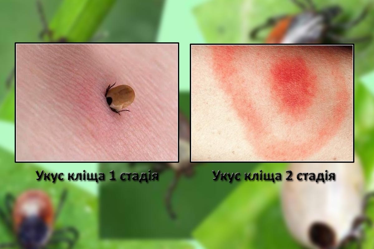 Как распознать и что делать при укусах насекомых (ФОТО) - fitdiets.ru