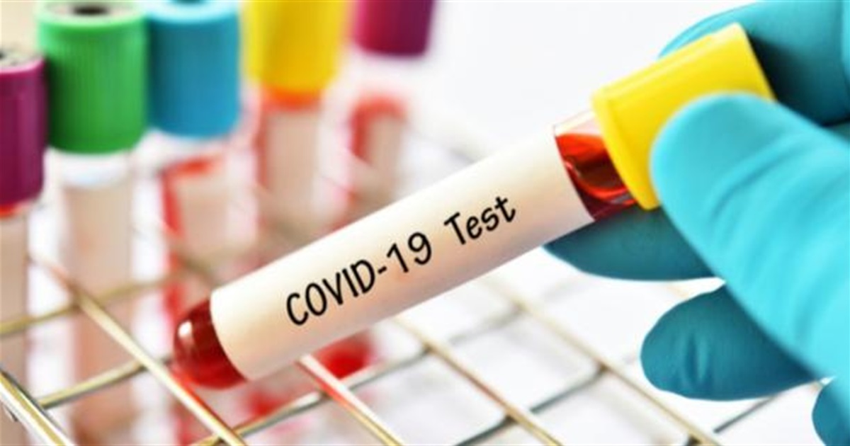 Кагарличчина: на COVID-19 хворіє 136 жителів громади