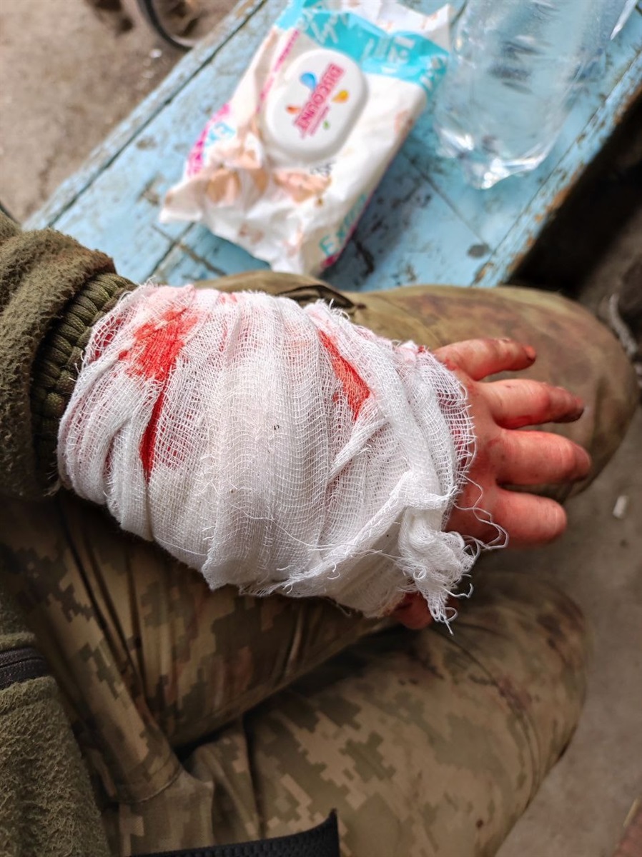 Після поранення Марія переживала, щоб їй не ампутували руку