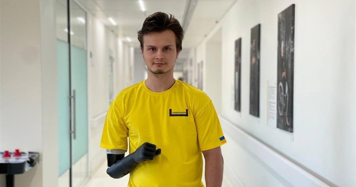 Захисник з Ірпеня втратив руку на фронті та отримав біонічний протез і вже навчається танців