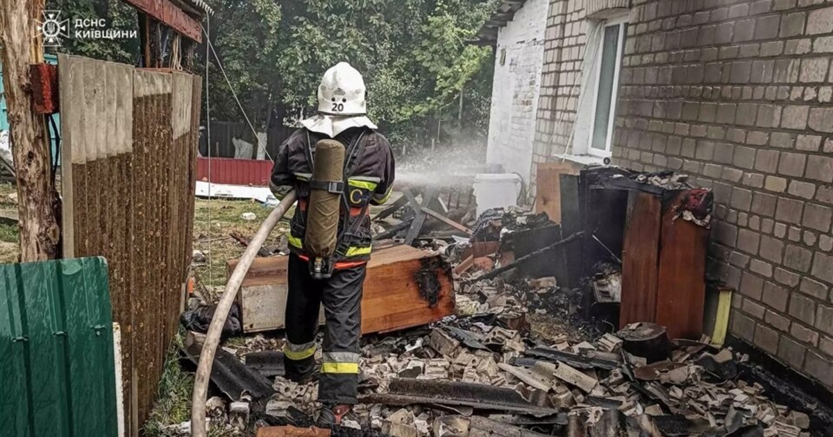 Отримав опіки - під час пожежі на Кагарличчині постраждав чоловік