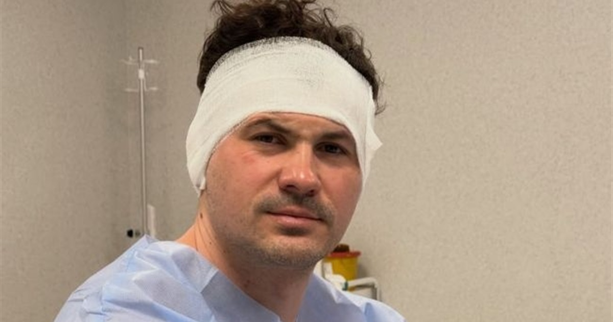 Хореограф Женя Кот переніс операцію, тепер проходить реабілітацію вдома