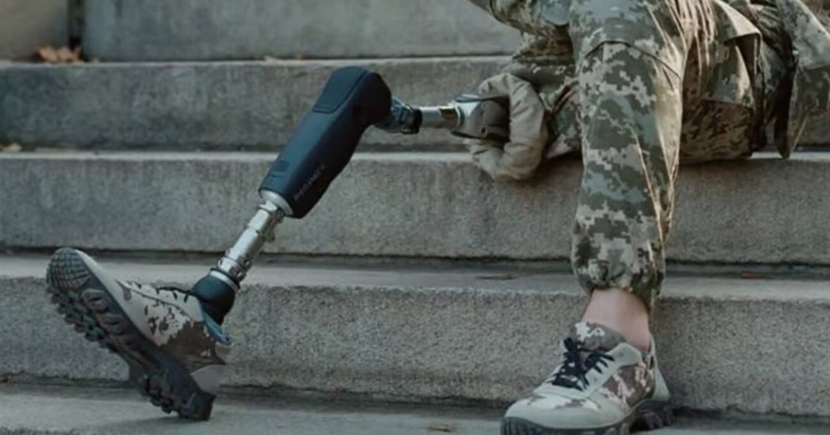 Як отримати безоплатний протез: інструкція для військових і цивільних