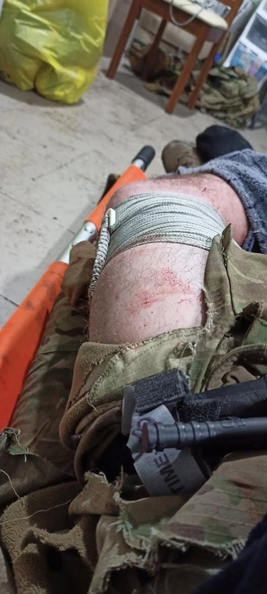 З пораненням на "Азовсталі"