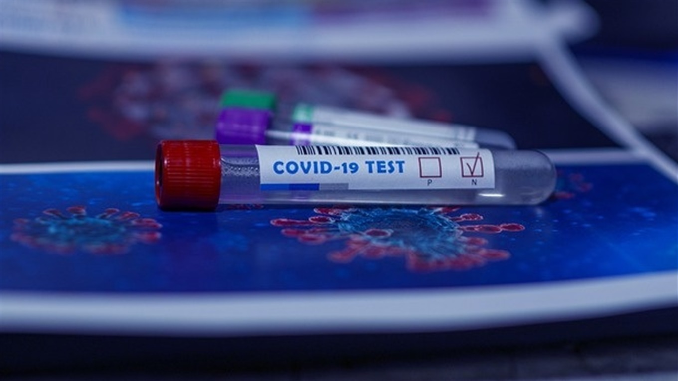 В Україні новий антирекорд, а на Скадовщині 4 нових випадки: статистика COVID-19 за 26 листопада