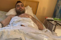 На мені заживає все, як на собаці. Доброволець Руслан Агаєв втратив обидві ноги на Луганщині