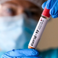 На Черкащині за тиждень — один летальний випадок від COVID-19