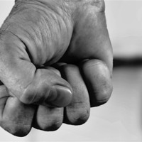 Після побиття мешканка Барської громади Леся Токова потребує допомоги