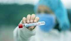 Я повернувся з-за кордону. Як не сидіти на самоізоляції 14 днів