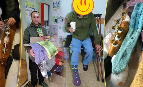 Жителька Переяславщини в’яже для поранених бійців шкарпетки, які можна одягнути на ноги зі штирями