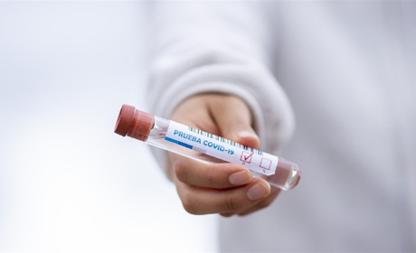 COVID-19: незважаючи на вихідні, кількість виявлених випадків захворювання зберігається