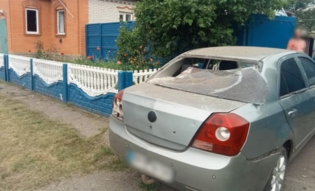 Жінка, яку поранило внаслідок обстрілу, загинула у лікарні