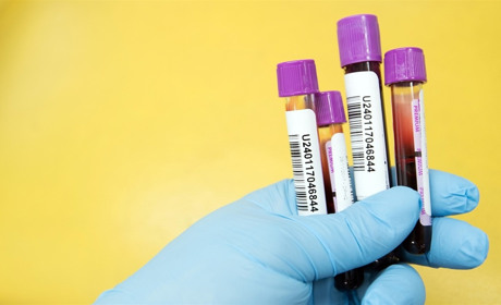 На Луганщині перша смерть від COVID-19. Ще у двох жителів області за минулу добу підтвердили хворобу