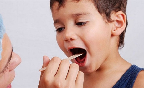 Ангіна: як швидко позбутися болю в горлі та запалення