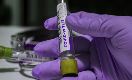 Плюс 392: кількість хворих на COVID-19 в Україні перевищила 9000