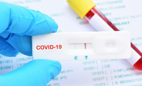 На вечір 12 червня підтверджено 6 нових випадків захворювання на коронавірус