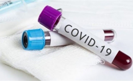 COVID-19: Нетішин перетнув позначку 400. За попередню добу статистика знову невтішна