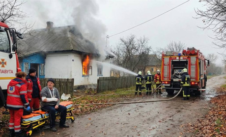 У Славуті під час пожежі в житловому будинку травмувався чоловік