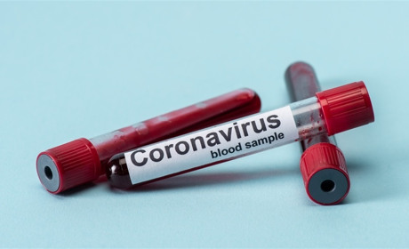 Статистика дня. Мелитополь все так же в лидерах по заболеваемости коронавирусом в области