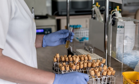 На Луганщині на COVID-19 захворіла ще одна людина. Кількість випадків в Україні збільшилася на 415