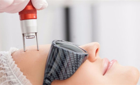 Глубокое погружение в процедуры шлифовки с помощью CO2-лазера