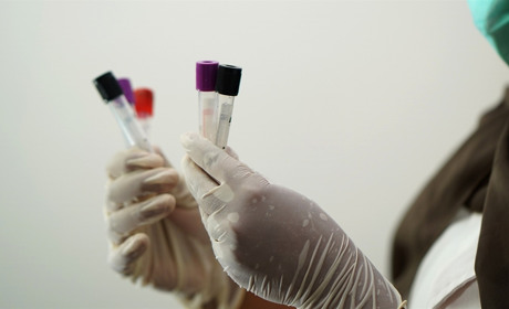 У Сватівському районі +13 хворих на COVID-19: яка ситуація з поширенням коронавірусу на Луганщині