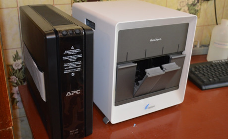 У Сватовому у райлікарні з’явився сучасний апарат для діагностики туберкульозу: чому це важливо