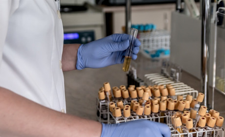 На Луганщині СOVID-19 виявили ще у однієї людини. Вона перебувала на самоізоляції