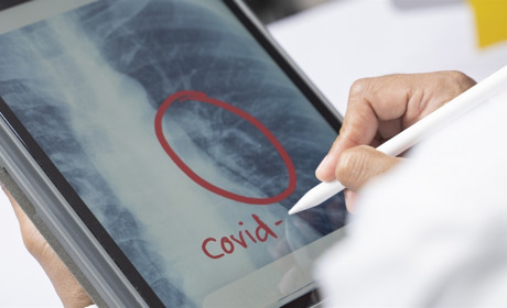 Ситуація з коронавірусом на 20 жовтня: на Володимиреччині 452 випадків захворювань, у Вараші – 703