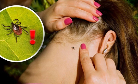 Кліщі виходять на полювання: як захистити себе та домашніх улюбленців