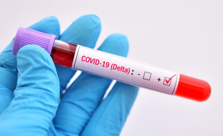 Правда чи міф? Фільтруємо новини про вакцинацію від COVID-19