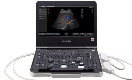 Інноваційне обладнання, що змінює медицину: нюанси, які потрібно врахувати покупцям