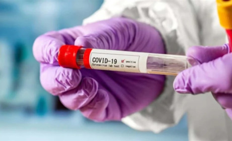 На Херсонщині зафіксували близько сотні випадків захворюваності на COVID-19